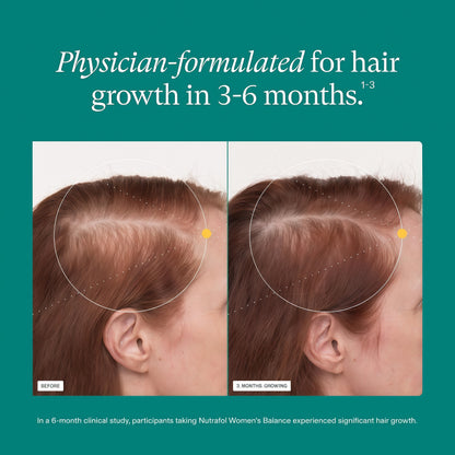 Hair Growth Supplement Brand